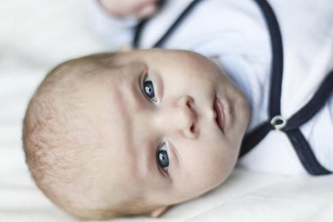 Hipospadias ya da yarım sünnet nedir?