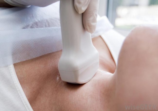 tiroglossal kist Tiroglossal Kist Nedir?